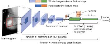RSNA Breast Cancer Detection